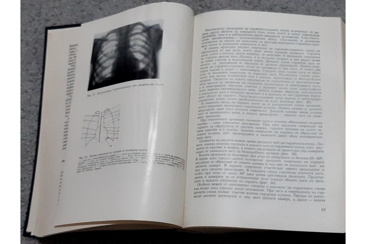 Антикварна медицинска литература  Болести сърдечно съдова система 1968